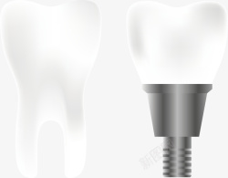 正常的牙齿和种植的牙齿矢量图素材