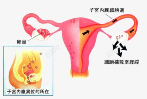 子宫示意图png免抠素材_88icon https://88icon.com 医学 子宫 生理 装饰