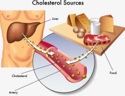 人体胆固醇来源分析图素材
