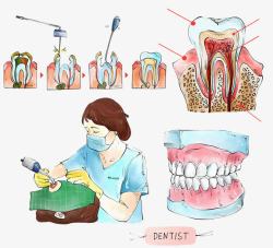 牙根牙医医疗插图高清图片