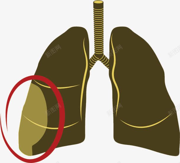 人体肺叶png免抠素材_88icon https://88icon.com 内脏 内部组织 呼吸道 肺管 身体器官