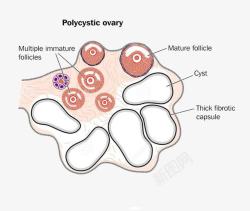 卵巢素材