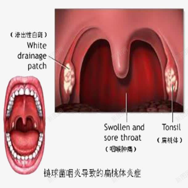 手绘喉咙细节图png免抠素材_88icon https://88icon.com 喉咙 喉咙发炎 嗓子