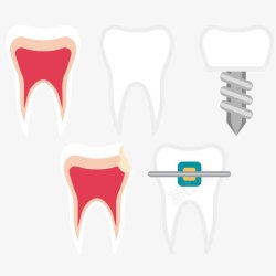 牙科牙齿矢量图素材