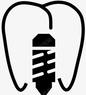 洗刷的牙齿前磨牙植入物螺钉口腔图标图标