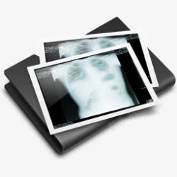 文件夹胸部X射线撬黑素材