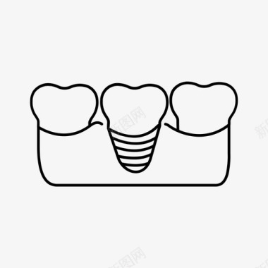 牙牙齿牙科植入物牙桥牙科护理图标图标