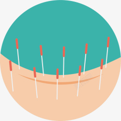 背部卡通针灸素材