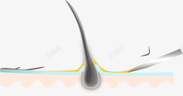 剃须挂去油脂和死皮矢量图ai免抠素材_88icon https://88icon.com 刀片 死皮 毛囊 油脂 皮肤切面 胡须 矢量图