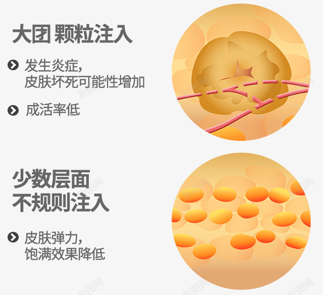 id脂肪移植纳米脂肪移植整体面部的自然饱满感塑造立png免抠素材_88icon https://88icon.com 脂肪 移植 纳米 整体 面部 自然 饱满 塑造