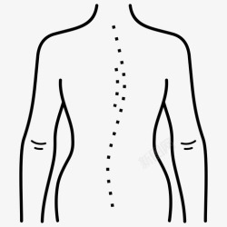 嵴柱疾病示意图体位缺陷脊柱脊柱前凸高清图片