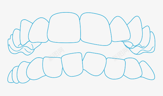 轻度牙齿不齐正畸配图png免抠素材_88icon https://88icon.com 轻度 牙齿 不齐 正畸 配图