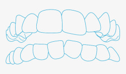 轻度牙齿不齐正畸配图素材