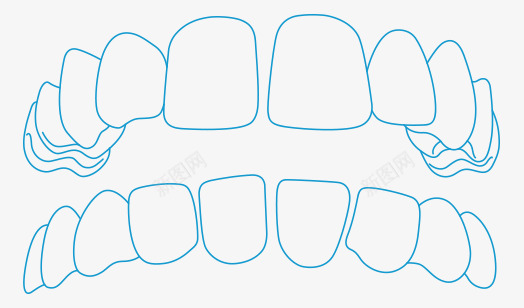 牙齿稀疏正畸配图png免抠素材_88icon https://88icon.com 牙齿 稀疏 正畸 配图