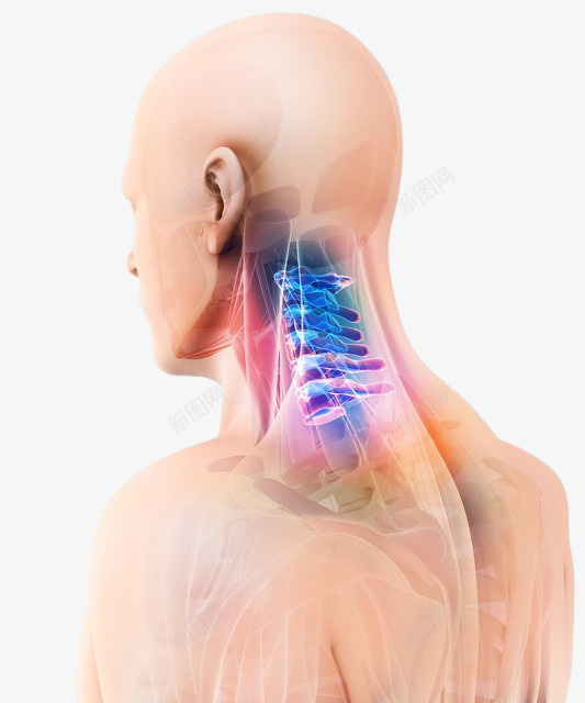 颈椎病脖子疼痛png免抠素材_88icon https://88icon.com 颈椎 脖子 3D渲染 人 头