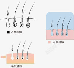 植发化妆品素材