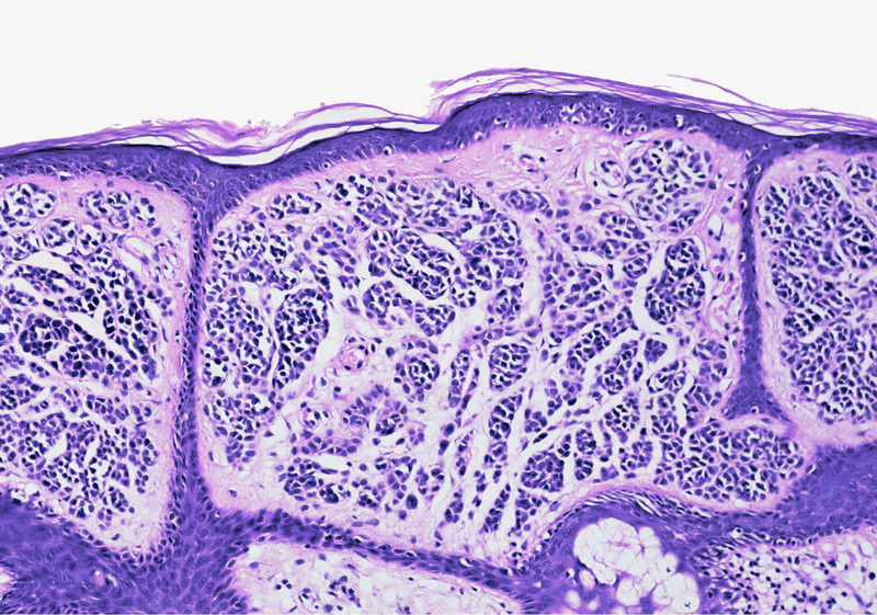 显微镜下的皮肤组织png免抠素材_88icon https://88icon.com 微生物 皮层组织 皮肤结构 细胞
