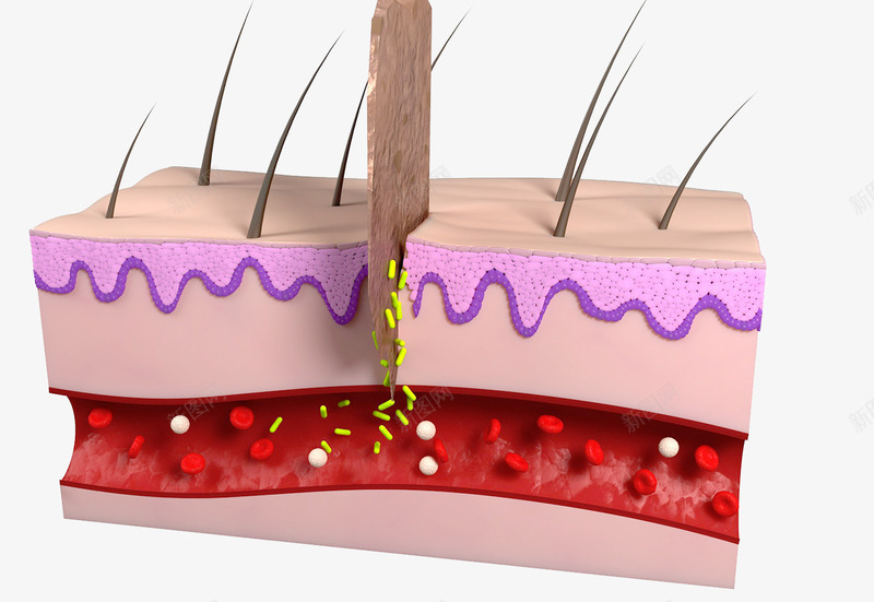 皮肤组织横切面png免抠素材_88icon https://88icon.com 毛囊 皮层组织 皮肤结构 血管