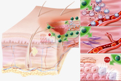 炎症皮肤炎症抗体高清图片