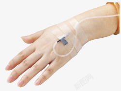 医疗输液器女性手上静脉注射的输液管高清图片