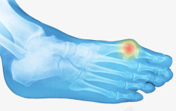 X射线骨脚趾骨X光透视图高清图片