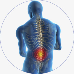 腰酸背疼腰痛贴人体透视图高清图片