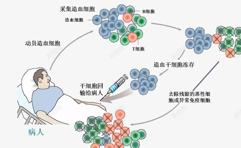 干细胞移植技术psd免抠素材_88icon https://88icon.com 干细胞 移植 肿瘤 造血干细胞