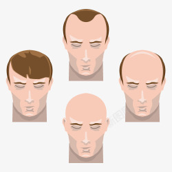 头发护理过程创意男子秃头到全头发过程高清图片