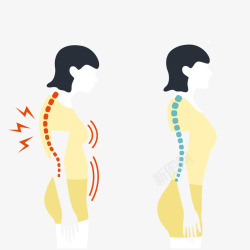 三面嵴柱女性脊骨损伤高清图片