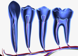 牙齿神经透视图素材