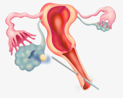 输卵管生殖系统医疗插图高清图片