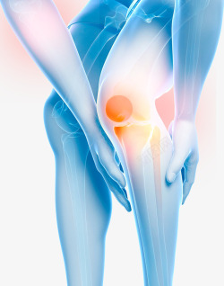 膝盖膝盖关节炎医疗插图高清图片