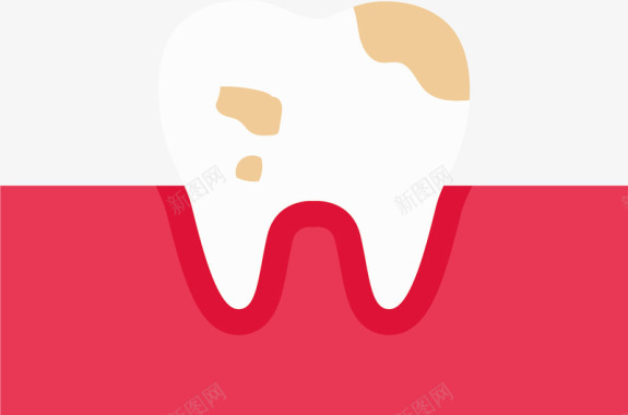 牙齿病毒牙床上的蛀牙矢量图图标图标