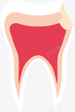 龋齿蛀牙矢量图图标图标