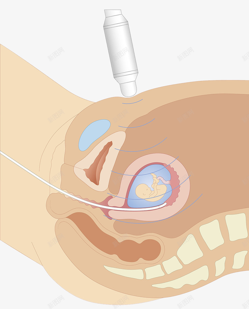 超声波胚胎探测png免抠素材_88icon https://88icon.com 人体结构 探测 生殖器官 生物科技 胚胎 超声波 输卵管