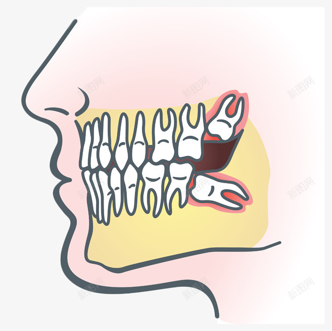 卡通头像牙齿智齿图示插画png免抠素材_88icon https://88icon.com 医学 卡通 图示 头像 插画 智齿 牙医 牙科 牙齿 牙齿修护卡通图