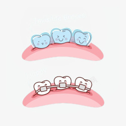 牙科矫正卡通可爱矫正牙齿两种牙套插画免高清图片