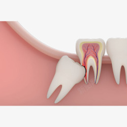 智齿卡通立体牙齿智齿牙痛高清图片
