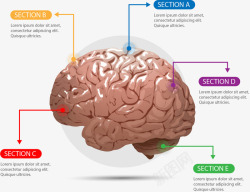 塑料大脑信息图表矢量图素材