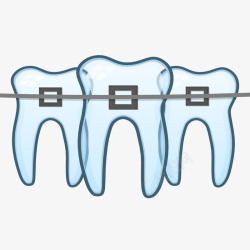 蓝色牙套卡通蓝色的牙齿固定在一起插画免图标高清图片