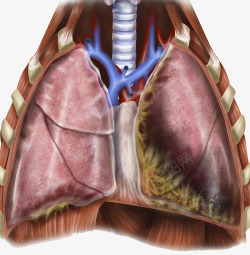 人体肺部结构解剖素材