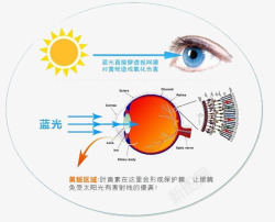 卡通眼病症状素材