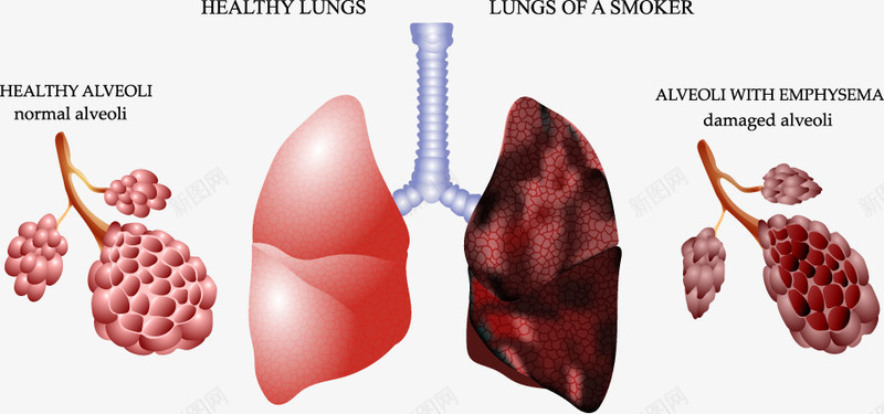 健康肺和香烟污染的肺对比图矢量图eps免抠素材_88icon https://88icon.com 人体器官研究 医学 肺 装饰 矢量图