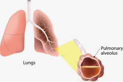 身体发病肺部素材