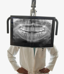 X光片口腔检查X光片高清图片