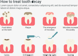 治疗龋齿图示如何治疗龋齿信息图表高清图片