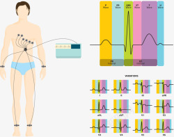 心电图人体信息图素材