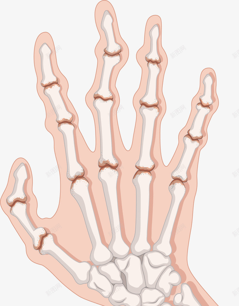 人体手掌骨骼png免抠素材_88icon https://88icon.com 人体骨骼 人类手掌 手指骨折 手掌 手掌骨骼 矢量png 重伤